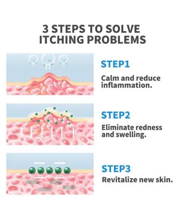 Chinese Herbal Psoriasis Cream for Skin Problems | Natural Skin Psoriasis Treatment - Buy Online on GoSupps.com
