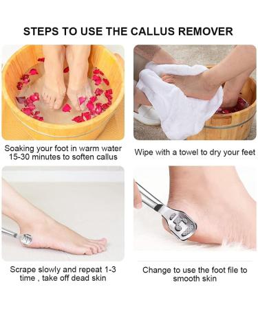 Foot Care Pedicure Callus Shaver Stainless Steel Foot Callus Remover Heel Razor Callus Shaver Sets Include 10 Replacement Slices and 1 Foot File Head Dry Hard Skin Remover for Hand Feet - Buy Online on GoSupps.com