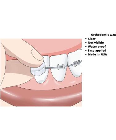 SmileWorld Lip Guard for Braces Bundle Set - Oral Relief for Orthodontic Braces - Buy Online on GoSupps.com