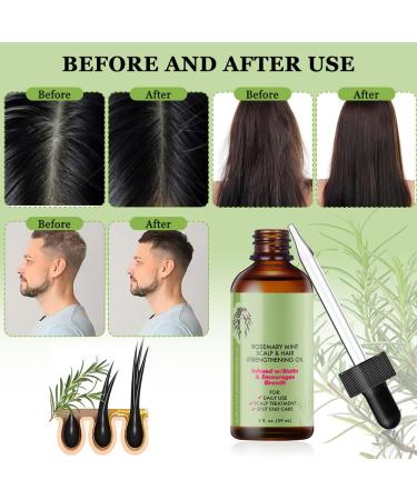 Fengyang Rosemary Oil for Hair Growth | Pure Rosemary Essential Oil for Thicker Hair - Buy Online on GoSupps.com