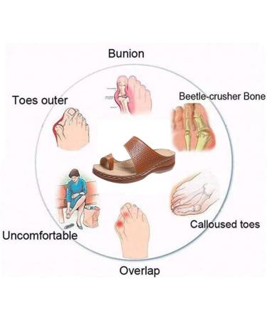 Women s Open Toe Sandals - Summer Hollow Clip Toe Bunion Corrector Wedge Heels & Flip Flops for Big Toe Bone Correction - Orthopedic Travel Footwear - Size 8.5 Red - Buy Online on GoSupps.com