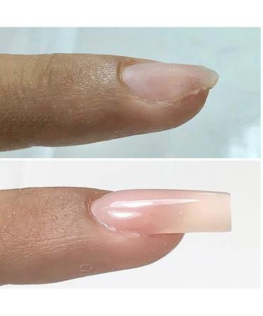 5ml Instant Cracked Nail Repair Gel - Nail Strengthener & Phototherapy Glue - Restore Weak, Broken, & Damaged Nails - Fast Fix for Nail Cracks - 1pc - Buy Online on GoSupps.com