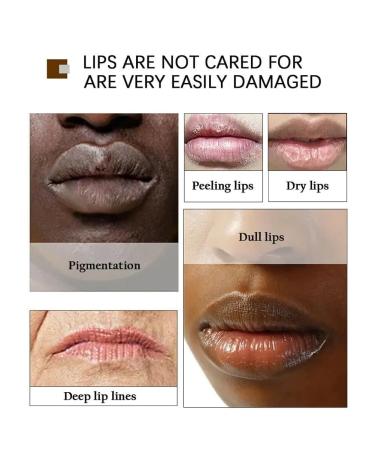 Cayes 2PCS Handmade Plant lip balm Pink Lips Serum Brighten Dark Lips Bleaching Essence Lip Balm Repair Fine Lines Brighten Moisture Exfoliator Lip Care (Yellow) - Buy Online on GoSupps.com