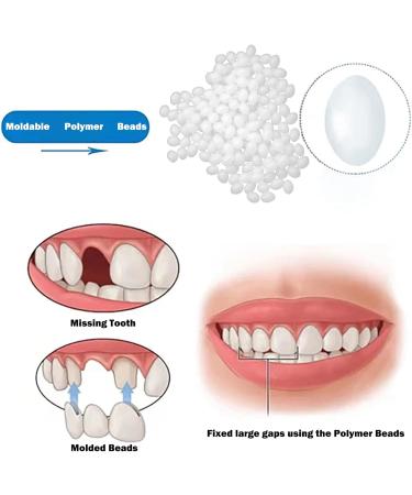 DIY Moldable Temporary Tooth Filling for Missing or Broken Teeth - 1pcs - Buy Online on GoSupps.com