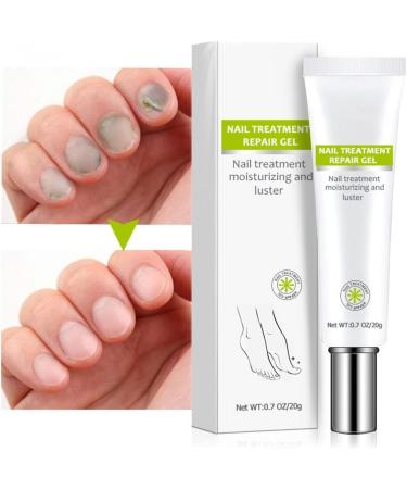 Dzhzuj Nail Treatment Repair Gel Toe Be Health Instant Beauty Gel for Nail Growth Caretoe Fungus Nail Treatment Extra Strength - Buy Online on GoSupps.com