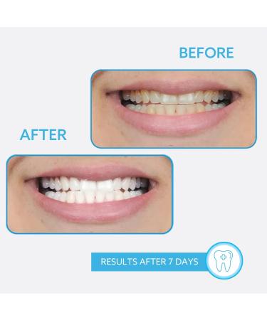 GO SMILE Extreme Duo Professional Teeth Whitening Travel Kit - 14 Whitening Swabs & Enamel Brush Pen in Portable Tin - Stain Remover, No Sensitivity - Buy Online on GoSupps.com