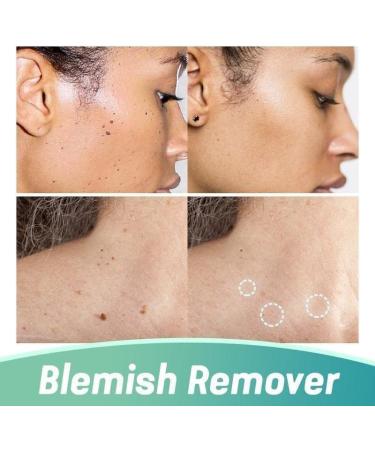 Wipe Off Tags and Mole Remover Skin Tag Remover & Mole Remover for Face Armpit Flesh Neck - Buy Online on GoSupps.com