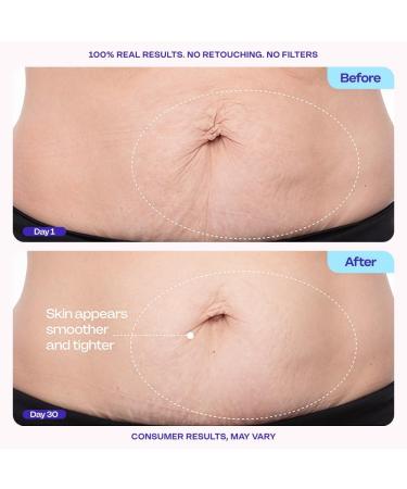 goPure Firming Belly Cream - Body Firming Moisturizer for Visible Cellulite & Stretch Mark Reduction 4.25oz 4.25 fluid ounces - Buy Online on GoSupps.com