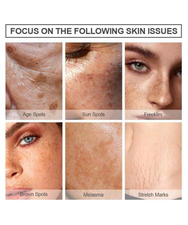 RADIANCE Dark Spot Corrector Serum | Arbutin Kojic Acid Vitamin C for Face & Body | Effective Melasma & Sun Damage Treatment for All - Buy Online on GoSupps.com