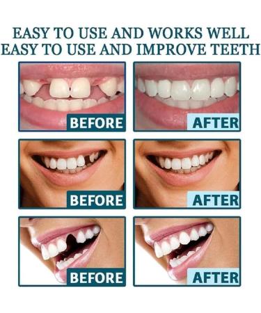 2 Pairs Nature and Comfortable Adjustable Temporary Women and Men Beautiful Smile (1) - Buy Online on GoSupps.com