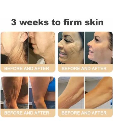 2026 New Advanced Firming and Wrinkle Reducing Serum Firming Skin and Body Shaping Care Massage Oil for Face and Body1Pcs - Buy Online on GoSupps.com