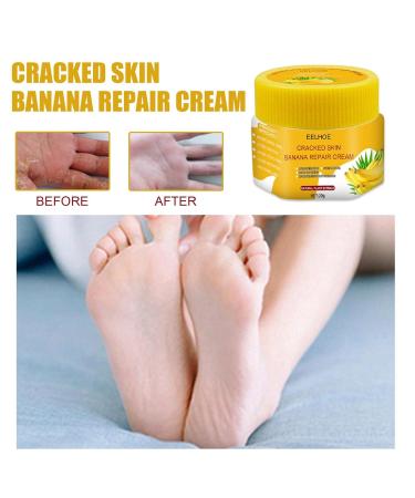 Yellow Banana Foot Cream - Natural Repair for Cracked Heels & Skin | 2PC 1g - Moisturize & Prevent Calluses - Buy Online on GoSupps.com