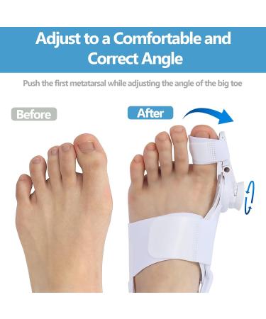 Bunion Corrector with Adjustable Toe Separators for Men & Women | Hallux Valgus Splint & Bunion Pads - Shop Now - Buy Online on GoSupps.com
