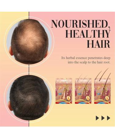Booster de cheveux avanc repousse des cheveux 7 jours au gingembre s rum de croissance des cheveux germinatif perte d'huile de coiffure essence de soin des cheveux pour hommes et femmes 30ML - Buy Online on GoSupps.com