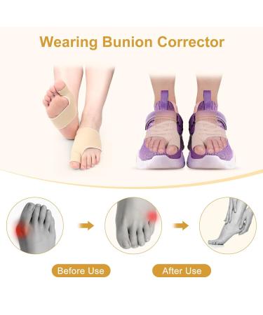 MxTimwan Hallux Valgus Socks - 2 Pairs for Toe Pain Relief | Beige Correction & Foot Comfort | Unisex Size L - Buy Online on GoSupps.com