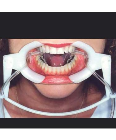 Pholk dental oral dry system retractor dental lip-cheek retractor Mund opener with saliva suction device tongue protection for tooth whitening orthodontic treatment