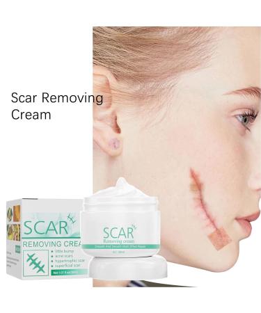 DAUERHAFT Scar Care Cream - Reduce Wrinkles, Surgery Scars, Irritation-Free - Women's Scar Removal Cream - Buy Online on GoSupps.com