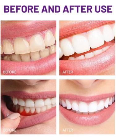 Mulberry Toothpaste Herbal Extracts Aloe Chamomile Sensitive Tooth Care Relieve Sore Teeth Improve Oral Discomfort 100g/ 3.38fl.oz - Buy Online on GoSupps.com