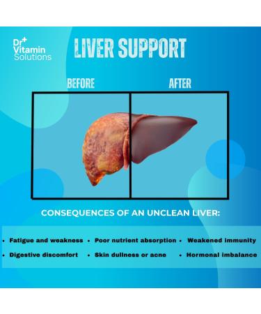 Liver Cleanse Detox and Repair - Milk Thistle Supplement with Chlorophyll Digestive Enzymes Artichoke & Dandelion for Natural Gallbladder Support 30 Vegan Capsules - Buy Online on GoSupps.com