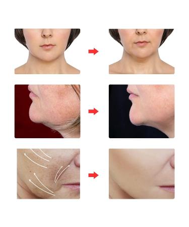 Beauty Face Sculpting Sleep Mask | V Line Shaping & Double Chin Reducer | Face & Chin Lifting Mask | Face Tightening Chin - 1pc - Buy Online on GoSupps.com
