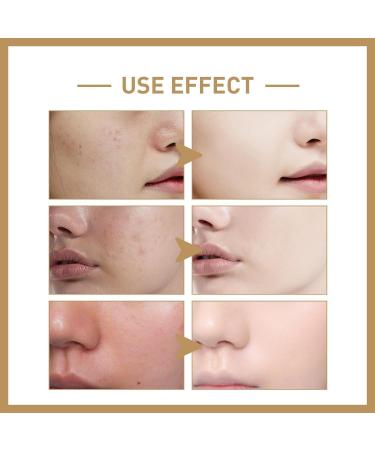 Skin Care Rice Toner Rice Facial Moisturizer 150ml Rice Facial Toner Korean Rice Toner Rice Moisturizing Toner Natural Rice Moisturizing And Hydrating (2 PC) - Buy Online on GoSupps.com