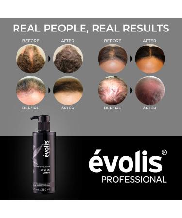 Volis Reverse Hair Growth Shampoo with Keratin & Wheat Protein - Sulfate-Free Treatment (8.5 fl oz) - Buy Online on GoSupps.com