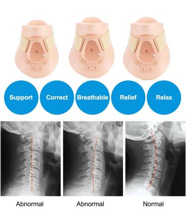 Fixation Spine Vertebra Care Halskrause - Neck Collar Support for Pain Relief | Philadelphia Cervical Collar (M) - Traction Device - Buy Online on GoSupps.com