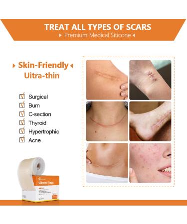 Medical Grade Silicone Scar Tape Roll - Postpartum Belly Band for Scars, Keloids, Burns & Thyroid - 1.6 x 60 | Effective Scars Removal Solution - Buy Online on GoSupps.com