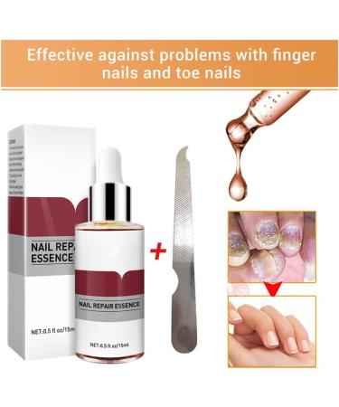1PC Nail Treatment Nail Renewal Solution Toenails & Fingernails Nail Repairs Essential Oil Protects From Discoloration Brittle And Cracked Nail(12ML) 111 - Buy Online on GoSupps.com