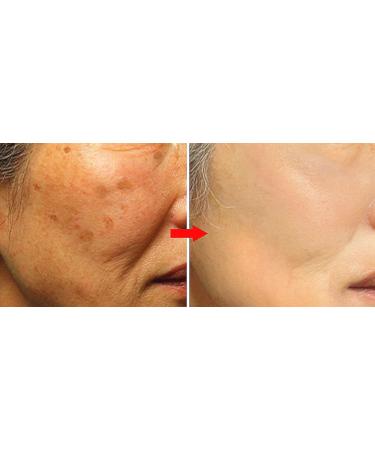 WHITESILK K-Beauty Stem Cell Wrinkle Capture & Volume-Up Overnight Power Cream with Volufiline(5%) & Bakuchiol(5%) (50ml) - Buy Online on GoSupps.com