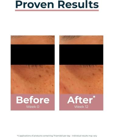  Eucerin Eucerin Anti-Pigment Eye Contour Cream 15 ml - Buy Online on GoSupps.com