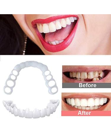 Xiaocui Teeth Prosthesis | Instant Perfect Smile Veneers | Comfort Fit Snap-On Cosmetic Dentistry - 2 Parts/Set - Buy Online on GoSupps.com