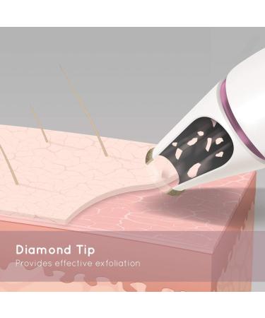 HoMedics Radiance Microdermabrasion Rose Gold - Professional Quality Salon Grade Deep Skin Exfoliation at Home Fast Treatment for Normal + Sensitive Skin Diminish Wrinkles Revitalise Skin HoMedics Radiance Microdermabrasion Rose Gold Professional Quality  - Buy Online on GoSupps.com