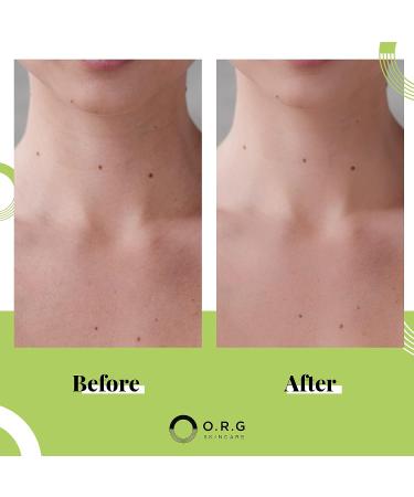 ORG Korean Deep Gel Exfoliating Body Scrub - Natural Cruelty Free Formula for Smooth & Glowing Skin - 6oz - Buy Online on GoSupps.com