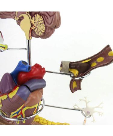 Model Model of Diabetes Complications Heart Pancreas Brain Neuron Model Foot Medical Communication Aids for The Diabetes Demonstration - Buy Online on GoSupps.com