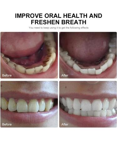 Coconut Oil Pulling Mouthwash - Mint Flavor Alcohol-Free Teeth Whitening & Tongue Scraper Set for Fresh Breath - Buy Online on GoSupps.com