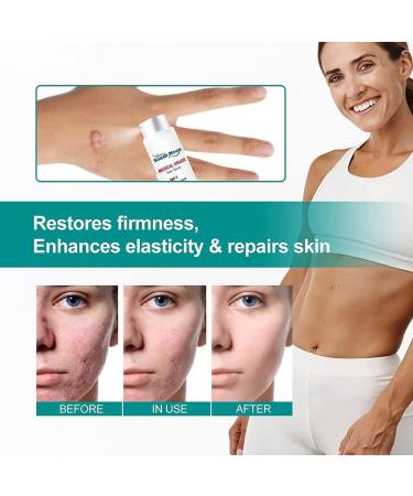Advanced Scar Removal Spray for All Types of Scars - Acne Treatment & Dark Spot Remover - Gentle Skin Care (1Pc) - Buy Online on GoSupps.com