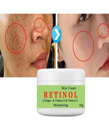 50ml*2PCS Crema para Las Manchas De La Cara Crema para La Cara Antiarrugas Face Moisturizing Cream para Piel Entrepierna Manchas Codos Piernas Zonas - Buy Online on GoSupps.com