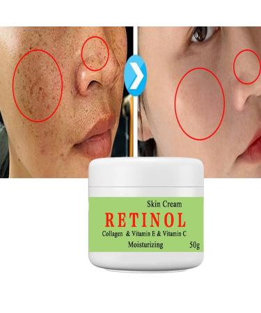 50ml*2PCS Cremas Para Las Manchas De La Cara Crema Para La Cara Antiarrugas Face Moisturizing Cream Para Piel Entrepierna Manchas Codos Piernas Zonas - Buy Online on GoSupps.com