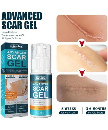 Scarremove Advanced Gel & Spray Set - Medical Grade Scar Remover for All Types of Scars - 2pcs - Buy Online on GoSupps.com