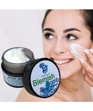 Diva Stuff Best Blemish Bomb Spot Treatment - Anti-Acne Cream for Men & Women | 1/4 oz Made in the USA - Buy Online on GoSupps.com