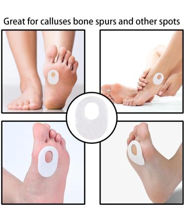 30 Oval Felt Callus Pads - Metatarsal Foot Cushions for Pain Relief | Adhesive Forefoot Protectors for Men & Women - Buy Online on GoSupps.com
