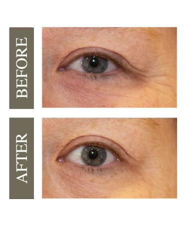 Hey Honey Open Your Eyes Lifting Eye Serum - Dark Circles & Puffiness Treatment - Buy Online on GoSupps.com