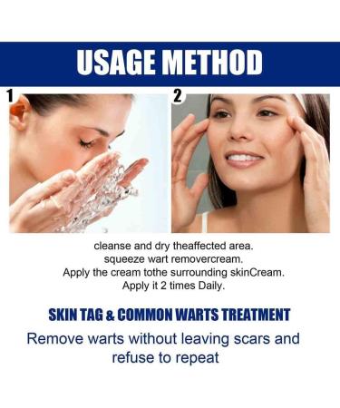 Wartsoff Instant Blemish Cream Wart Remover Cream Safe Natural Extract Wart Remover Ointment Warts Remover Wart Removal Ointment Against Warts - Buy Online on GoSupps.com