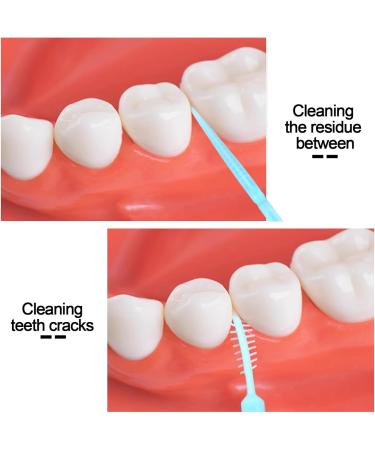 Medsuo 100PCs Blue Plastic Dental Picks - Soft Interdental Brushes & Flossing Tools for Portable Oral Care - Buy Online on GoSupps.com