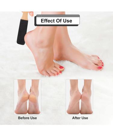 2PC Foot File Pumice Stone and Callus Remover Foot Rasp Pumice Stone for Feet Foot Scrubber with Wooden Handle Exfoliator Pedicure Tool for Dead Skin Foot Cracked Heels Hard Skin - Buy Online on GoSupps.com