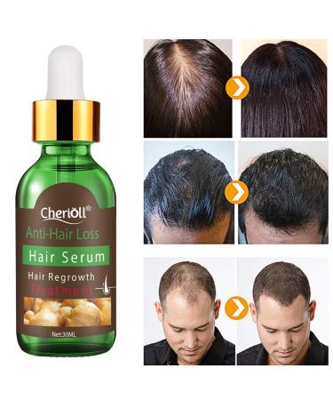 Hair Growth Serum - Stimulate New Growth, Thicker & Fuller Hair - Hair Loss & Thinning Treatment - Buy Online on GoSupps.com