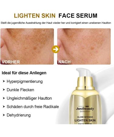 Glow Intense Collagen Brightening Kit Body Lotion Face Cream Serum Toner Purify Hydrate Brighten With Collagen Niacinamide Vitamin C (1. Kilogram) - Buy Online on GoSupps.com