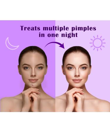 Curvy Pimple Patch for Large Spots - Fast & Effective Acne Treatment | Shop Now - Buy Online on GoSupps.com