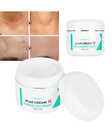 Scar Removal Cream - Pregnancy, Acne, Facial & Skin Repair Treatment Gel - Buy Online on GoSupps.com